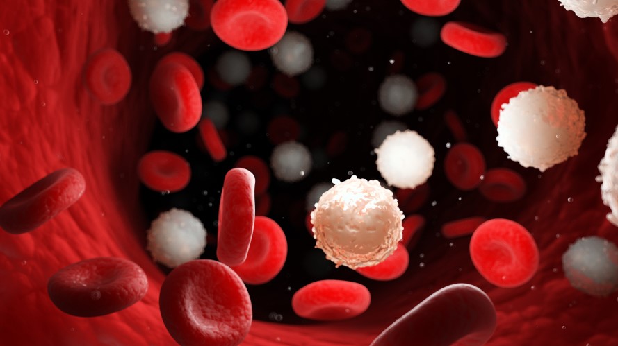 XNK partners with Swedish hospital to develop AML therapy