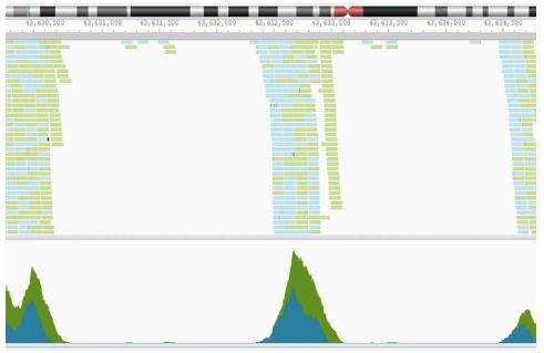 exome sequencing